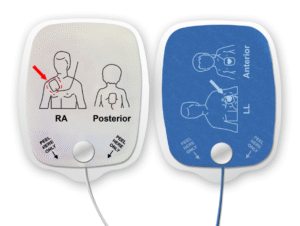 defib pad placement heartsync defib pads