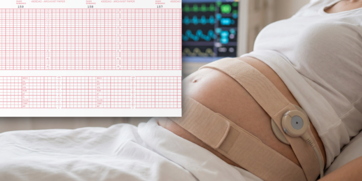 Complete Guide to Fetal Monitoring Strips for Labor & Delivery Units