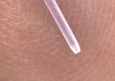 DFM for Micro Molding: What Changes at Micro Scale