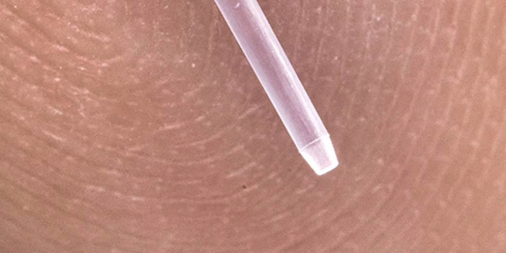 DFM for Micro Molding: What Changes at Micro Scale